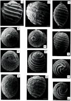 Fig. 3 - Carófitos da associação de Amblyochara sp - Neuquenocypris minor mineira (todas as barras de referência são equivalentes a 100 micra). Compilado de (Dias-Brito 2001).